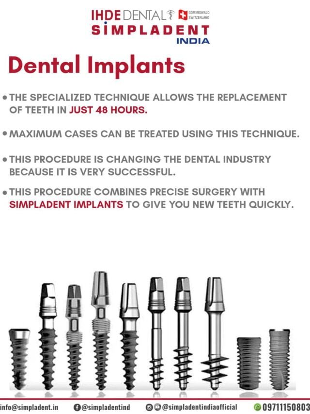 Unlock Your Perfect Smile: The Magic of Dental Implants